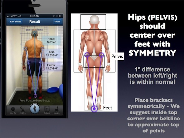 posturezone posture app symmetry