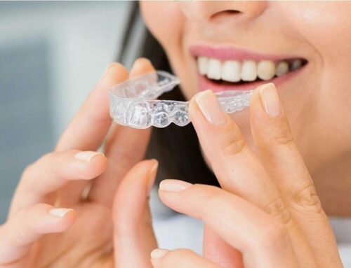 Veneers vs. Invisalign: Pros and Cons